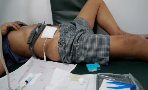 Accompagnement pour la dialyse péritonéale avec Abigael Infirmière, Redon, ABIGAEL INFIRMIERE